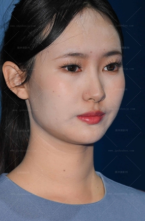 251121-12-63√奔驰肉丝礼仪，喜欢哪个呢？